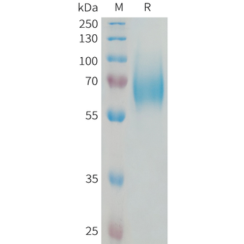 Human DLL1 Protein, His Tag