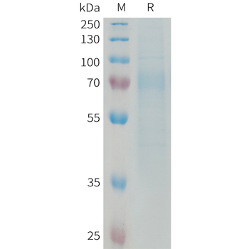 Human KIR2DL1 Protein, His Tag