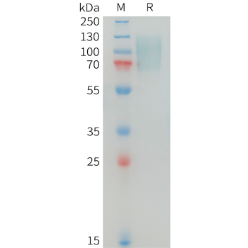 Human FGF19 Protein, hFc Tag