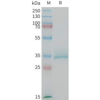Human IFNAR2 Protein, His Tag