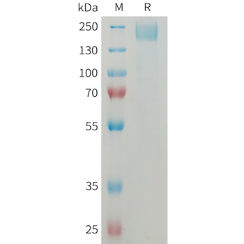 Human LAMP5 Protein, His Tag