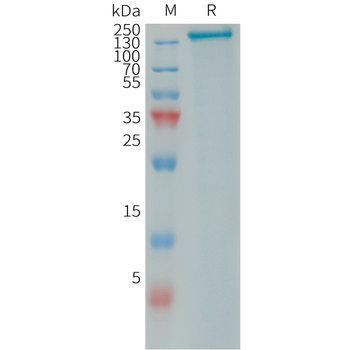 Human IL1R2 Protein, mFc Tag