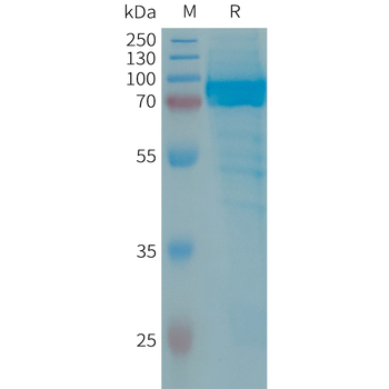 Human IL1RA Protein, mFc Tag