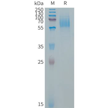 Human CEACAM5(496-685) Protein, His Tag