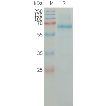 Human VEGF121 Protein, hFc Tag