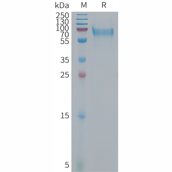 Human CCL17 Protein, hFc Tag