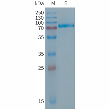 Human HMGB1 Protein, His Tag