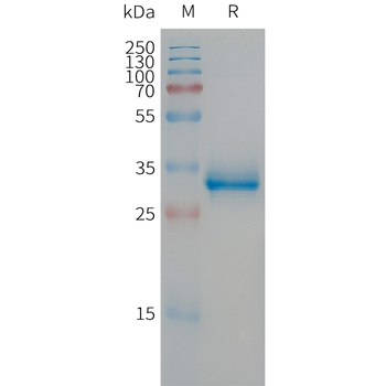 Human CXCL10 Protein, hFc Tag