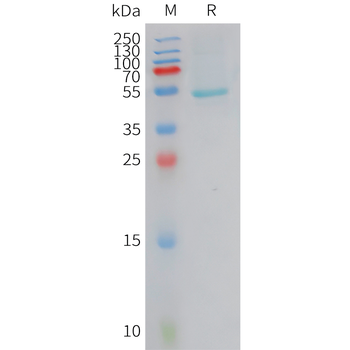 Human CD117(206-316) Protein, hFc Tag
