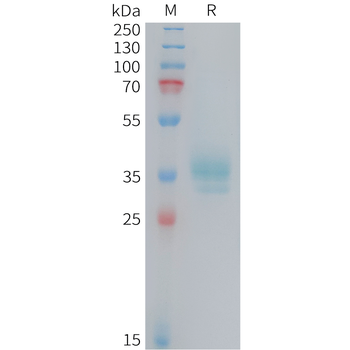 Human NGF(19-241) Protein, hFc Tag