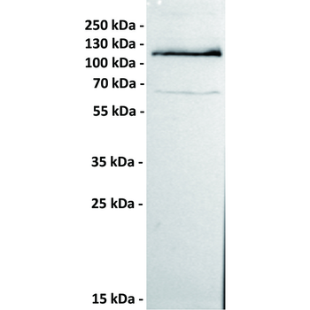 ROR1 Antibody
