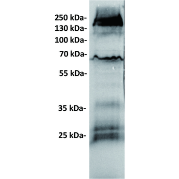 GUCY2C Antibody