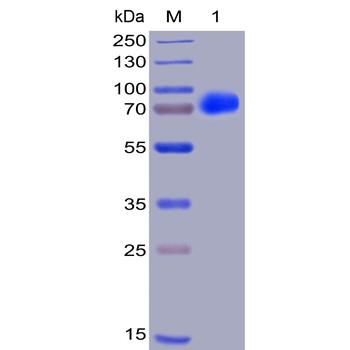Human CS1 Protein, hFc-His Tag
