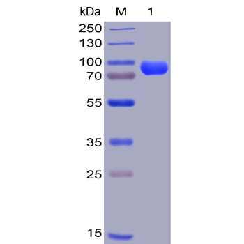 Human CD38 Protein, hFc-His Tag