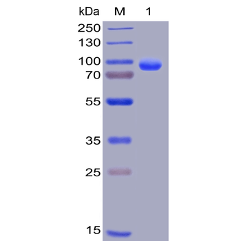Human CD138 Protein, hFc-His Tag