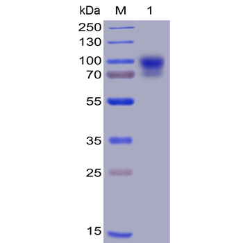 Human SIRPa Protein, hFc-His Tag