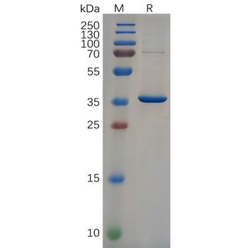 Human 4-1BB Protein, mFc-His Tag