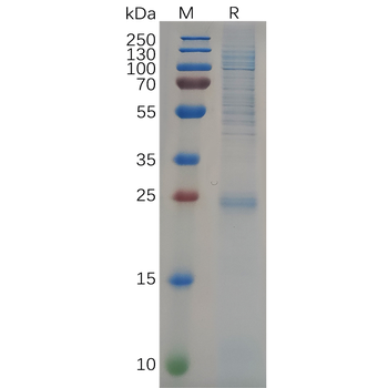 Human B7-H3 Protein, mFc-His Tag