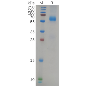 Human CD48 Protein, mFc-His Tag