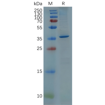 Human CTLA-4 Protein, mFc-His Tag