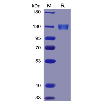 Human GITR Protein, hFc-His tag