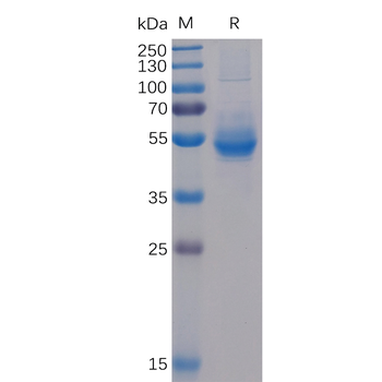 SARS-CoV-2 (2019-nCoV) S protein RBD, His Tag