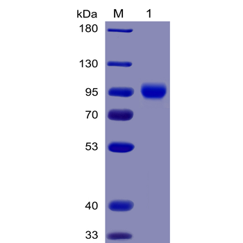Human CD19 Protein, hFc-His tag