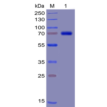 Human CD70 Protein, mFc-His Tag