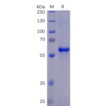 Human BTLA Protein, mFc-His Tag