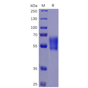 Human DNAM-1 Protein, mFc-His Tag