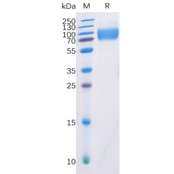 Human BTN3A1 Protein, mFc-His Tag
