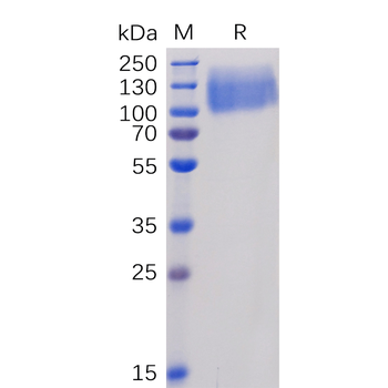 Human ACE2 Protein, hFc Tag