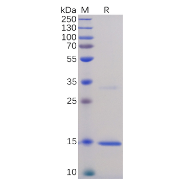 Human TNFa Protein, His Tag