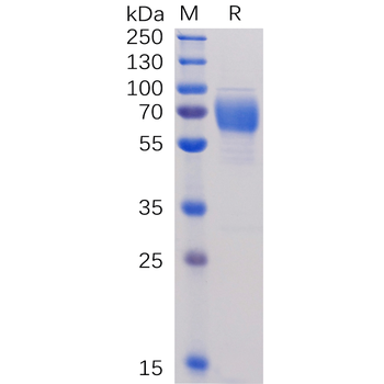 Human NKG2D Protein, mFc Tag