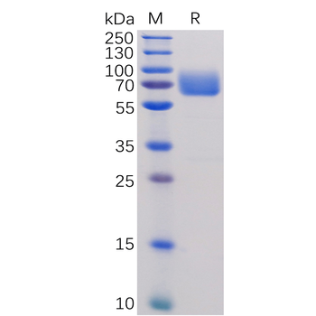 Human NKp30 Protein, hFc Tag