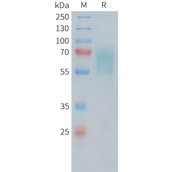 Human IL5 Protein, His Tag