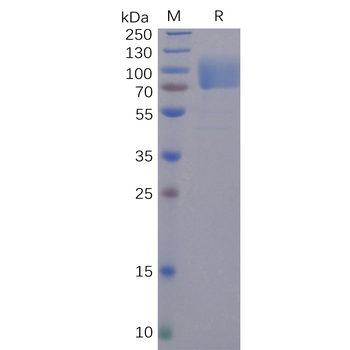 Human CD37 Protein, hFc Tag