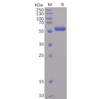 Human IL5RA Protein, His Tag