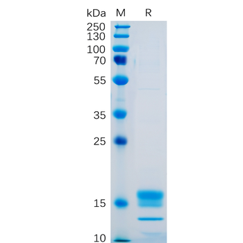 Human CD46 Protein, His Tag