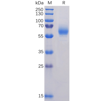 Human CD40 Ligand Protein, hFc Tag