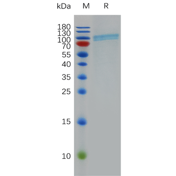 Human SIGLEC15 Protein, mFc-His Tag