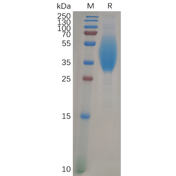 SARS-CoV-2 (2019-nCoV) S protein RBD, mFc-His Tag