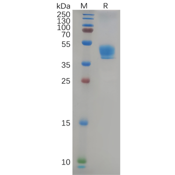 Human CD7 Protein, mFc Tag