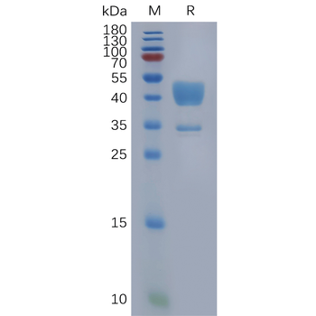 Human CD34 Protein, His Tag