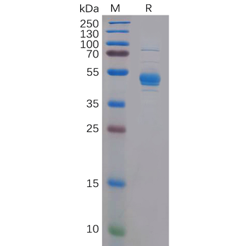 Human CD162 Protein, His Tag