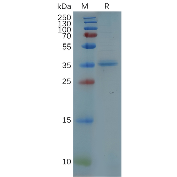 Human CD27 Protein, hFc Tag