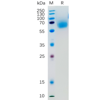 Human CD70 Protein, hFc-His Tag