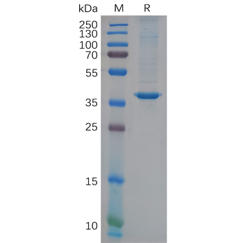 SARS-CoV-2 (2019-nCoV) S1 protein NTD, mFc Tag