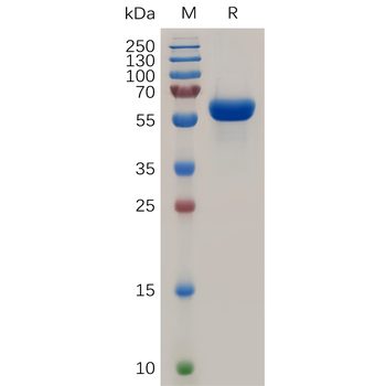 SARS-CoV-2 (2019-nCoV) S1 protein CTD, hFc Tag