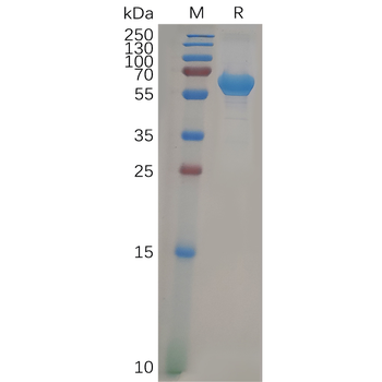 SARS-CoV-2 Spike-Membrane Recombinant Fusion Protein, His Tag